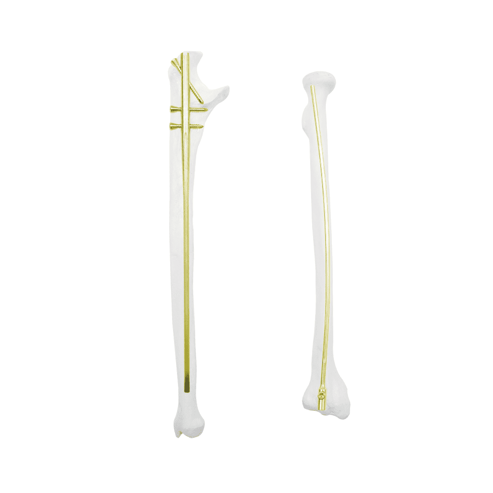 QML Multi-Dimensional Ulna & Radius Intramedullary Nail System