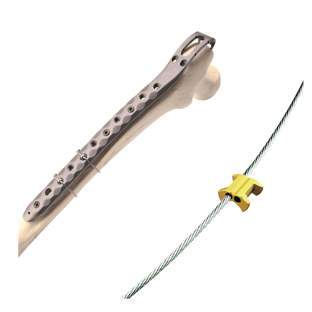 Titanium Cable Detail