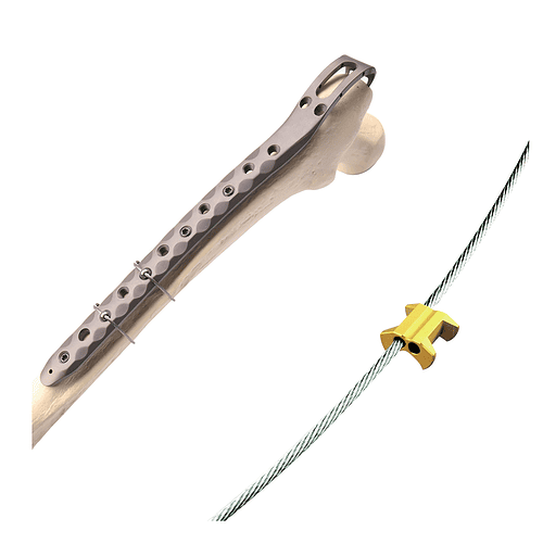 Titanium Cable System