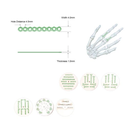 TML 1.5 Phalangeal Metacarpal Plate System